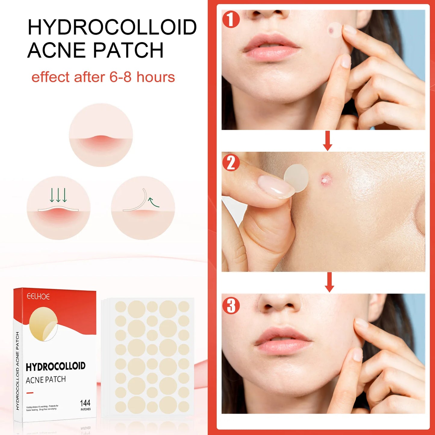 Hydrocolloid Acne Patches - Invisible Pimple Repair Patches