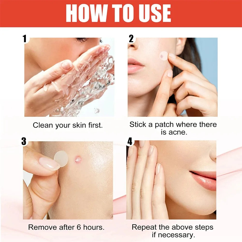 Hydrocolloid Acne Patches - Invisible Pimple Repair Patches