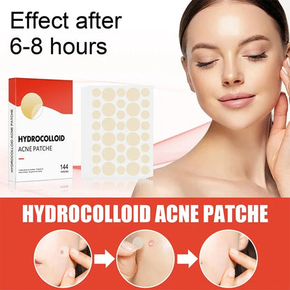 Hydrocolloid Acne Patches - Invisible Pimple Repair Patches