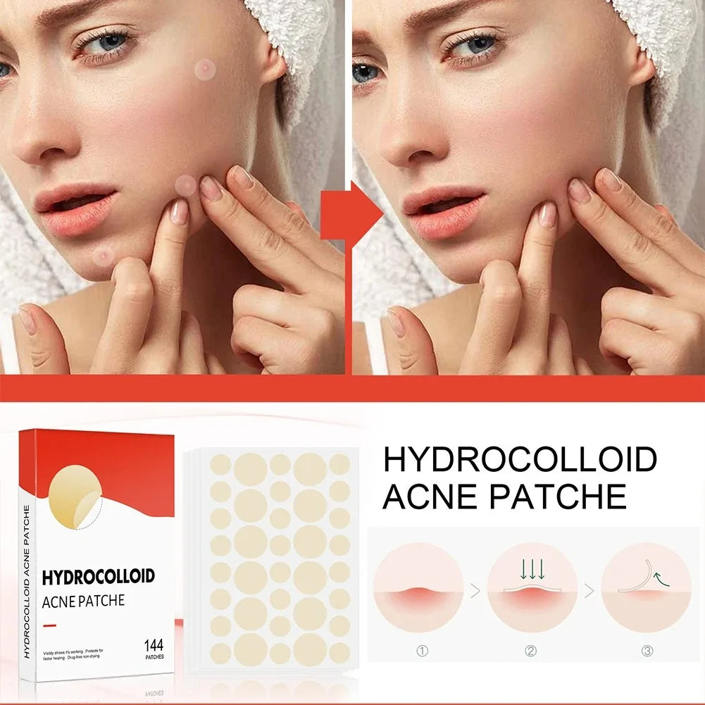 Hydrocolloid Acne Patches - Invisible Pimple Repair Patches